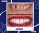 Slider image (5) Universe Dental - Best Dental Clinic in Tbilisi, Georgia